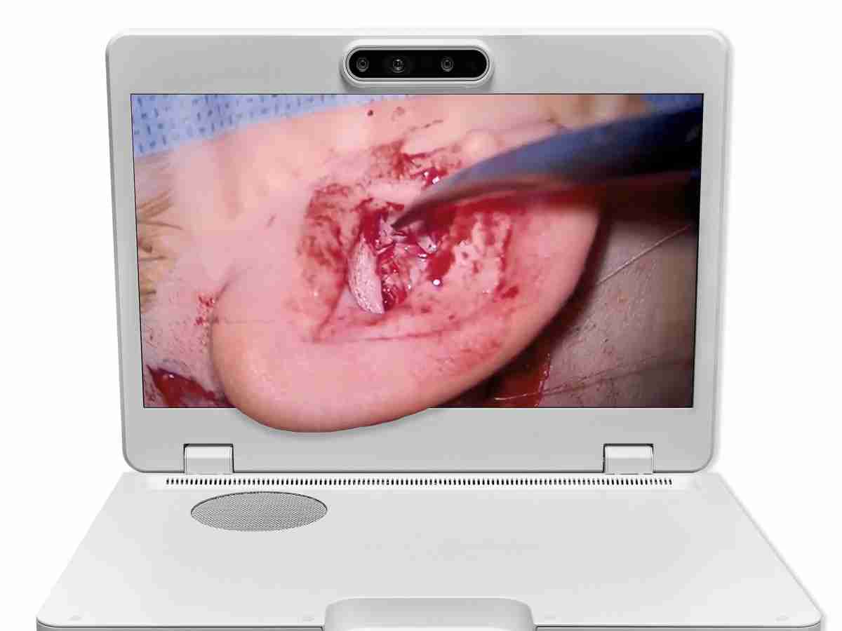 达擎之＂Heads-up 3D显微手术显示系统＂，，，整合4K裸眼3D显示及眼球追踪系统，，，，具备快速追踪人眼移动位置功能，，，减轻医师长时间维持固定姿势的负担，，，，让医师能有更宽广清晰的3D立体视野及更舒适的姿势来执行手术。。。。